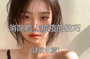 脸上粉刺怎么去除（脸上粉刺怎么去除）