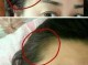 两鬓出现白发,为什么出现白发的原因