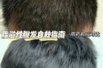 油脂性脱发怎么治疗（油脂性脱发怎么治疗最好）
