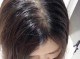 头发很容易油是什么原因（头发很容易油是什么原因）