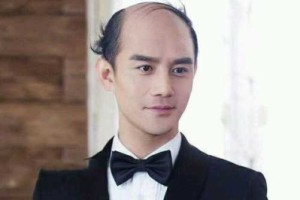 有什么头发（“地中海”形容什么发型）