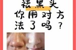 如何去除脸上的黑头和毛孔,怎么能去黑头缩小毛孔呢