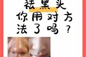 如何去除脸上的黑头和毛孔,怎么能去黑头缩小毛孔呢