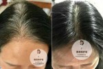 怎么让白头发变成黑头发（怎么让白头发变成黑头发的办法）
