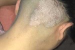 头皮屑突然增多是什么原因（女性头皮屑突然增多是什么原因）