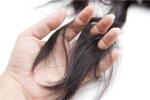 秋季头发掉的厉害怎么办（秋季头发掉的厉害怎么办女性）