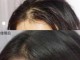 儒意生姜洗发水用后掉发什么原因,女生脱头发是什么原因引起的