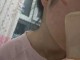卷发棒烫伤怎么办（被电卷发棒烫伤怎么办）