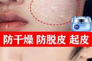 孕期脸上脱皮怎么办,孕妇皮肤干燥起皮用什么护肤品比较好