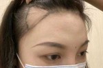 秃额角适合什么发型女（额角两边秃怎么剪女生刘海）