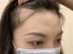 秃额角适合什么发型女（额角两边秃怎么剪女生刘海）