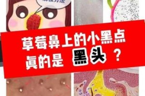黑头怎么快速消除（黑头怎么快速消除小妙招）