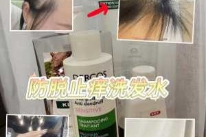 用什么可以长头发（用什么可以长头发和预防脱头发）