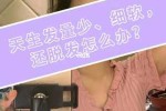 头发细软怎么改善,发丝细软怎么办掉头发