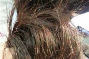 头发断是什么原因（我的头发总是从半截的地方断）