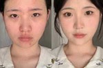 圆脸什么样（面部扁平是什么样的）