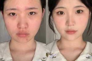 圆脸什么样（面部扁平是什么样的）