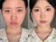 圆脸什么样（面部扁平是什么样的）