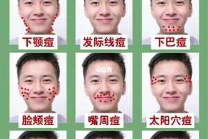 男生怎么祛痘（男生怎么祛痘最有效的方法）