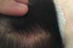 孩子头上有白色小块状的头皮屑，可以用什么药物吗,头上有白头发是什么原因引起的