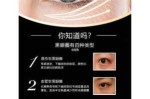 眼睛有黑眼圈怎么去除（怎样快速有效的去除黑眼圈）