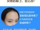 发际线后移怎么解决,发际线怎么后移的