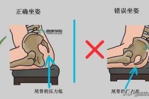 马尾骨疼怎么回事（马尾骨鱼属于几级保护动物）