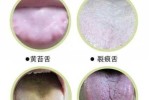 色头发黄是什么原因（为什么有些人的头发偏金黄）