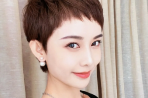 前面头发稀少适合什么发型,额前头发稀少怎么治疗