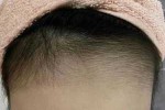 额头上有毛发怎么办（额头上有毛发怎么办小妙招）