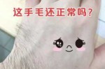 我的手背、脚上毛很长，请问体毛长有没有怎么方法治疗呢,毛发太多怎么办女生