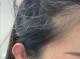 有白发了怎么办啊（有白发了怎么办啊女生）