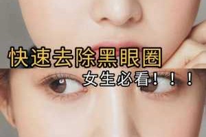 黑眼圈如何快速去除,怎么去黑眼圈简单方法最有效