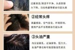 头皮屑多头皮痒怎么办（头皮屑多头皮痒怎么办小妙招）