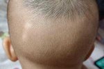 9个月宝宝头顶头发稀少怎么办给宝宝吃什么补,女生头顶头发少适合什么发型图片