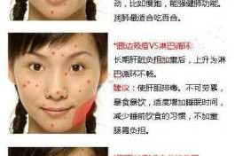 下巴长痘是怎么了（下巴长痘是怎么了女性）