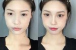 长脸女生适合什么鼻子,长脸适合做什么鼻子好看