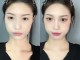 长脸女生适合什么鼻子,长脸适合做什么鼻子好看