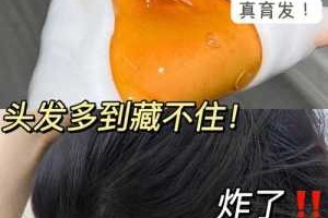 头发油怎么办掉头发（头发油怎么办掉头发多）