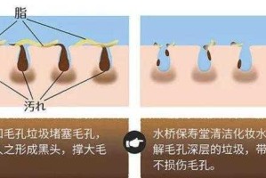 怎么取黑头（怎么取黑头以后不长）