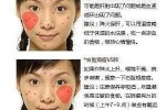 脸上长痘痘怎么快速去除,脸上长痘痘怎么快速去除?