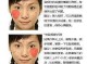 脸上长痘痘怎么快速去除,脸上长痘痘怎么快速去除?