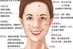 脸上长青春痘怎么（脸上长青春痘怎么）