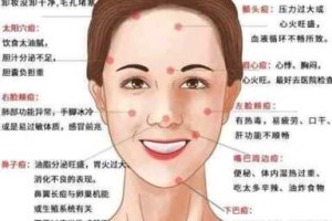 脸上长青春痘怎么（脸上长青春痘怎么）