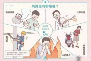 烟花烫伤后怎么处理（汽车天窗玻璃被烟花烫伤怎么处理）