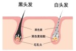 耳朵上面俩边长满了白发怎么办?是什么原因,吃什么治疗白头发最快