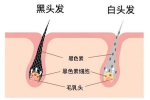 耳朵上面俩边长满了白发怎么办?是什么原因,吃什么治疗白头发最快