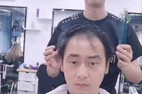 男的头顶头发少怎么办（男的头顶头发少怎么办）