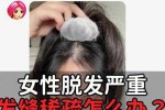 女性掉头发怎么办?吃什么药好,女人头发掉怎么办怎样改善