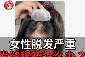 女性掉头发怎么办?吃什么药好,女人头发掉怎么办怎样改善